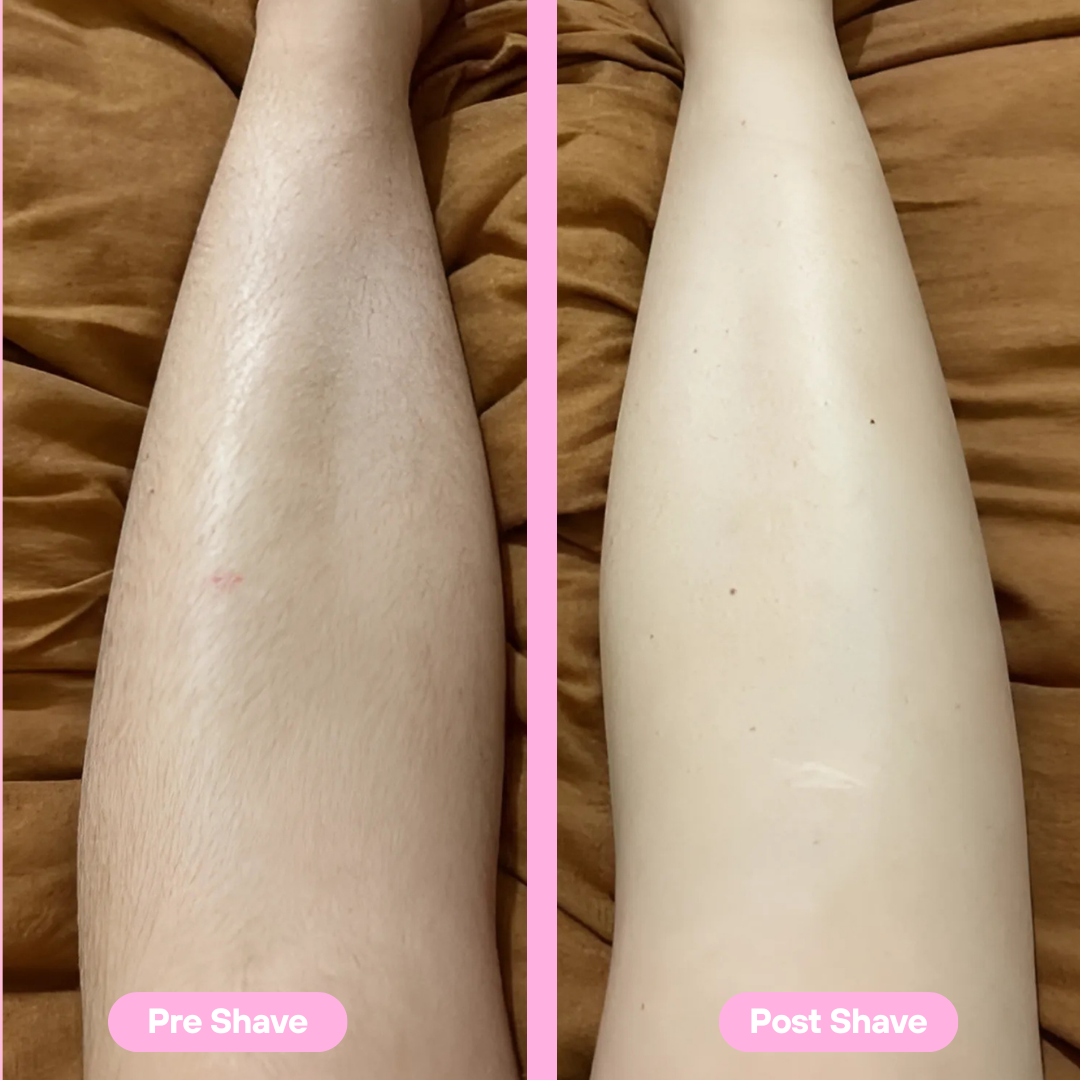 SilkDerm Pro