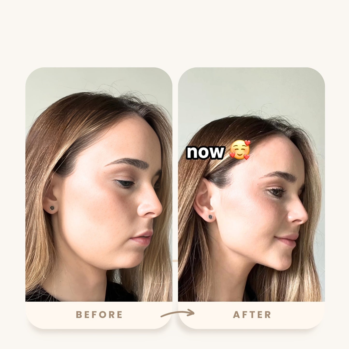 Lyftr Face Device