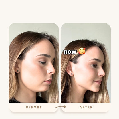 Lyftr Face Device
